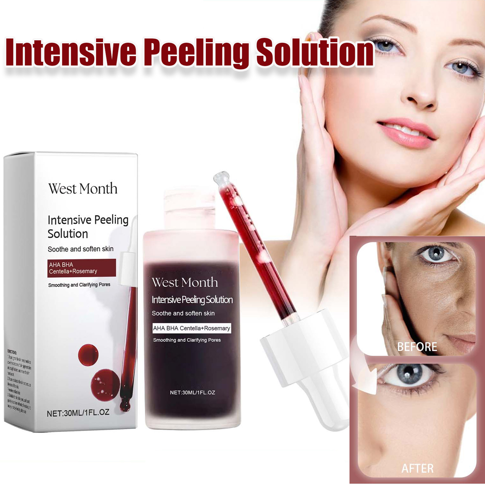 Azelaic Acid Serum - Sérum Peeling pour le visage, Anti-acné,
