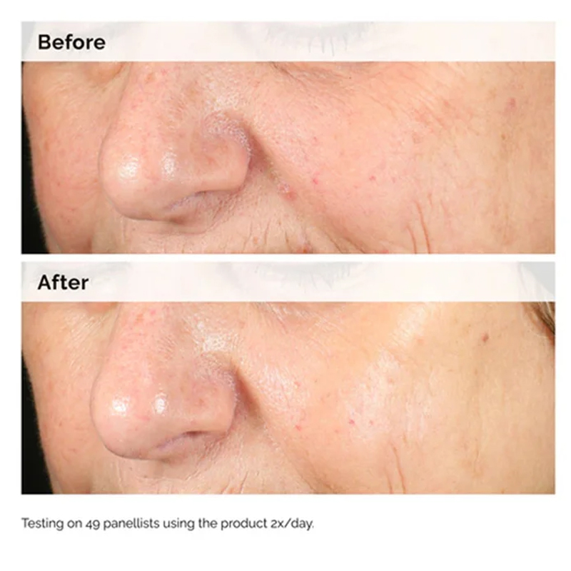 Alpha Arbutin 2% + HA 30ml Sér - Azelaic Acid Serum avis et prix
