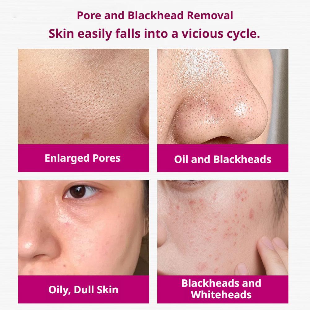 Sérum à l'acide salicylique po - Azelaic Acid Serum avis et prix
