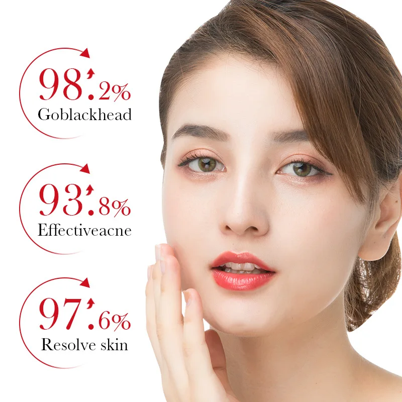 BIOAQUA acide salicylique élim - Azelaic Acid Serum avis et prix